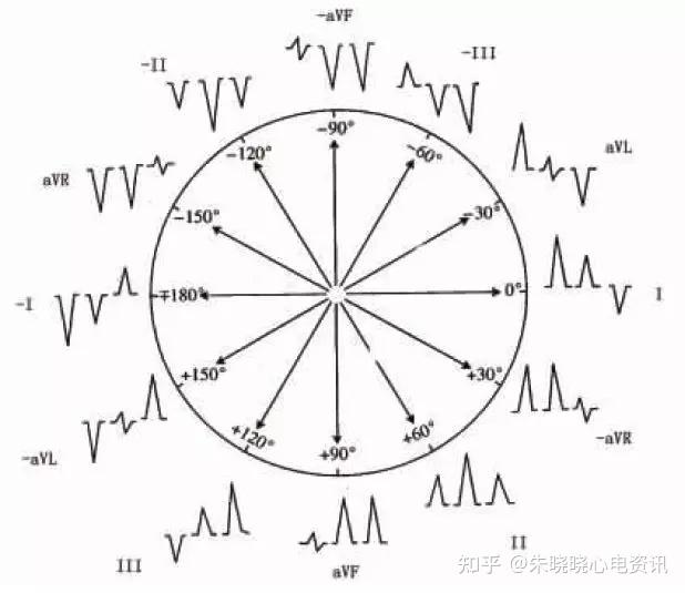 心電軸的測量方法你掌握了幾種