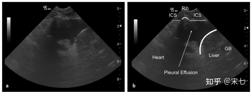 猫传腹(fip)的影像诊断