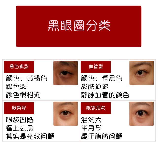 眼霜能去黑眼圈眼袋泪沟皱纹脂肪粒吗