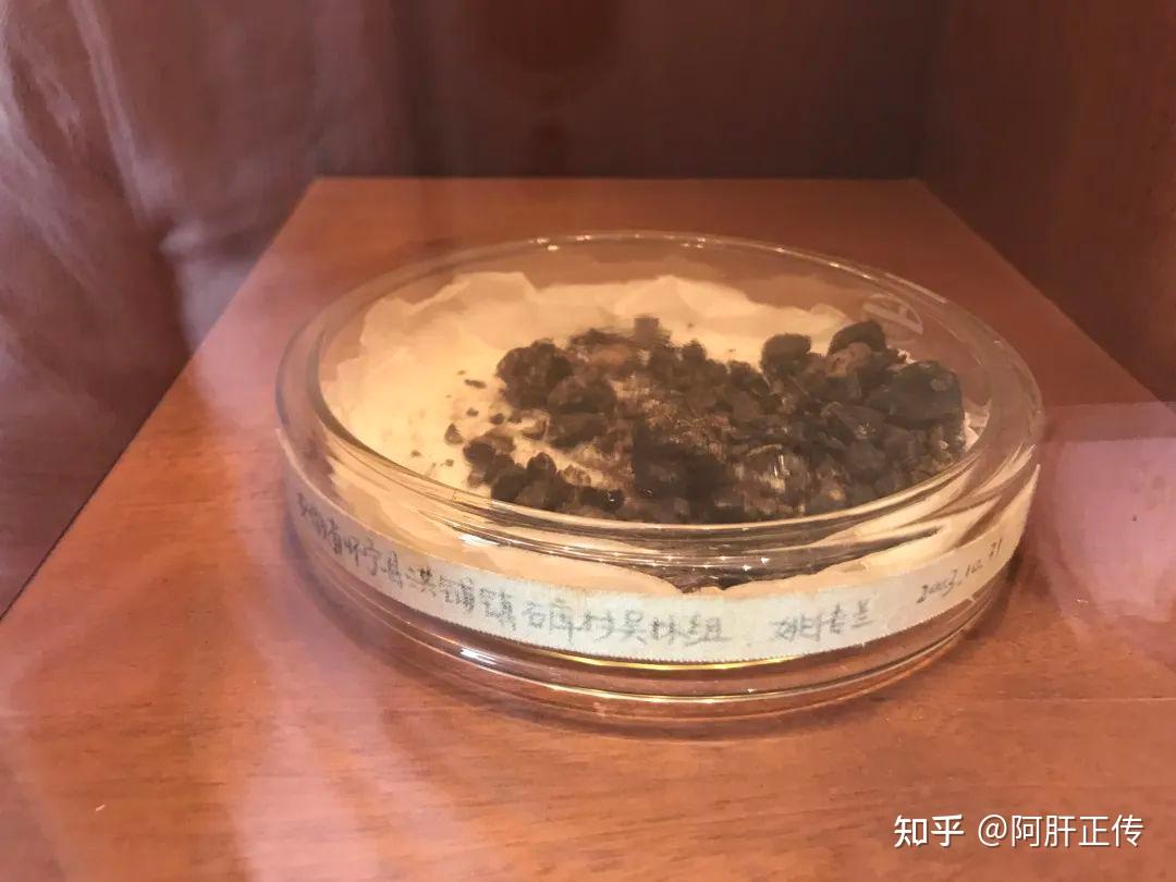 通过中医药治疗自然排出的胆囊结石