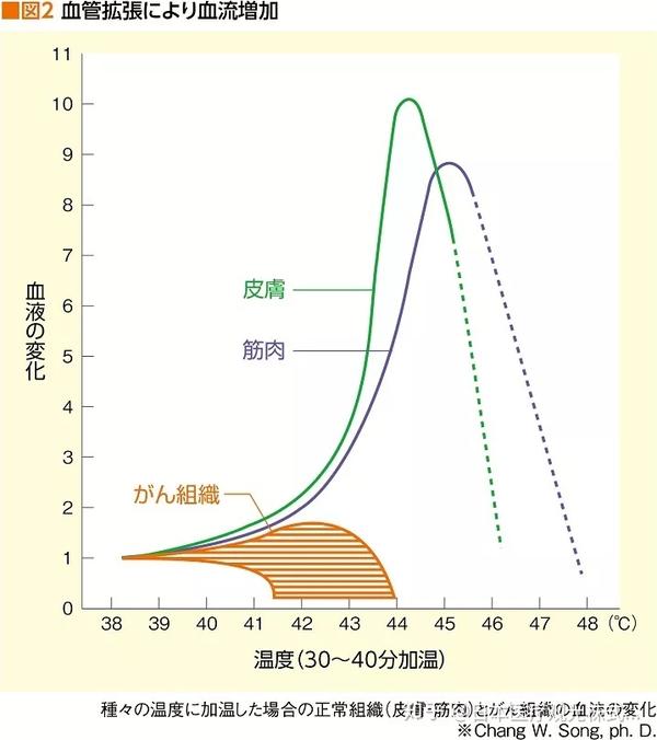 热疗 与抗癌药和放射线疗法的标准治疗并用有惊人效果 知乎