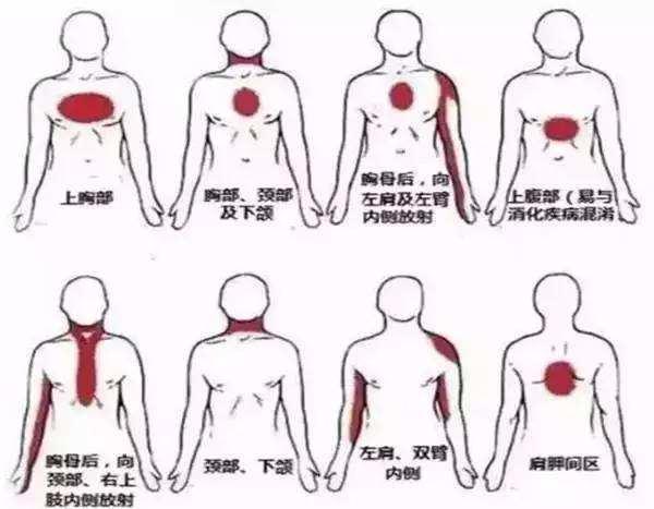 胸口中间疼是什么原因图片