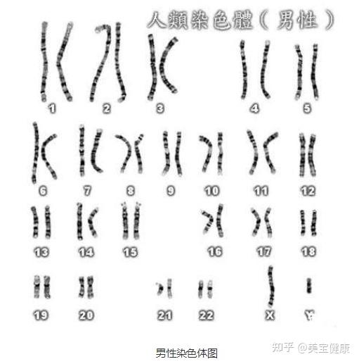 25 岁已婚女子竟被意外查出染色体核型结果为46xy是男性