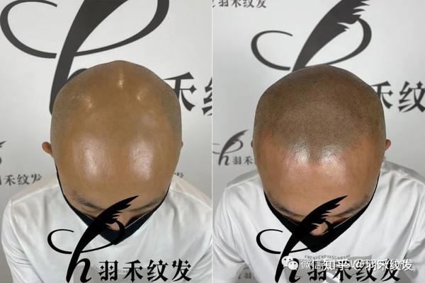 纹发可以模仿头发不同长度 - 知乎