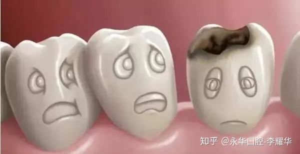 牙疼别硬撑 教你几个止疼绝招 知乎