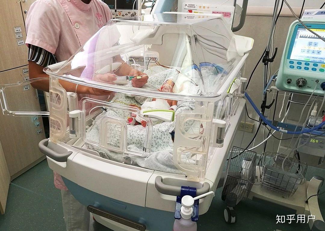 早产儿34周容易活吗? - 知乎