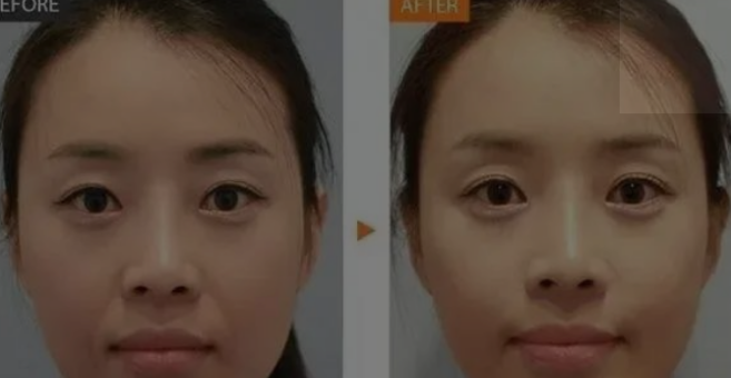 v2-db497f5b07aa73e3b907e094b74af76c_1440w.jpg?source=172ae18b