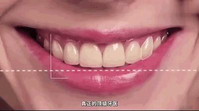 完美笑线丨你不知道的关于笑容的秘密 - 知乎