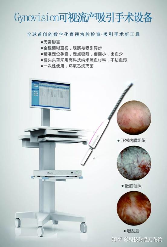 gynovision可视流产吸引手术设备此项技术是基于最大限度保护子宫安全