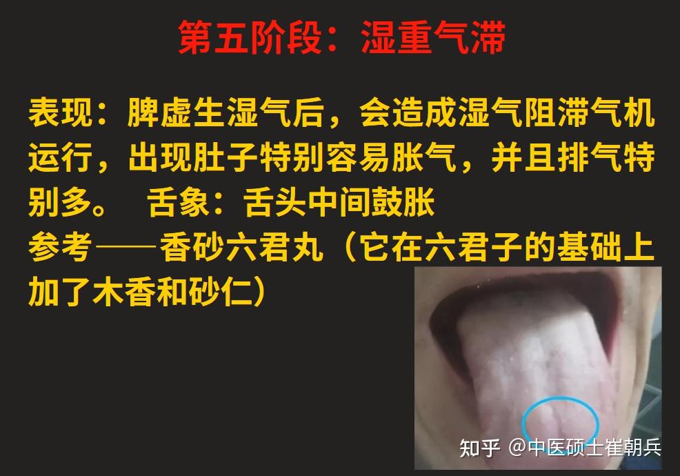 脾气虚、脾阳虚,由轻到重,看看自己的脾虚在哪个阶段?12个阶段的脾虚一次讲明白 - 知乎