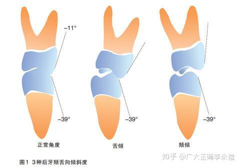你的咬合关系正常吗?不知道的,进来自测!