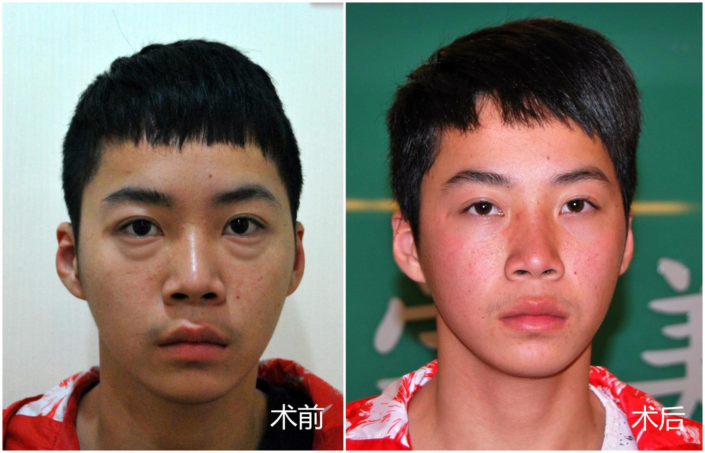 v2-dbbfd9cb68afeb21a82c9b8a68e7769d_1440w.jpg?source=172ae18b