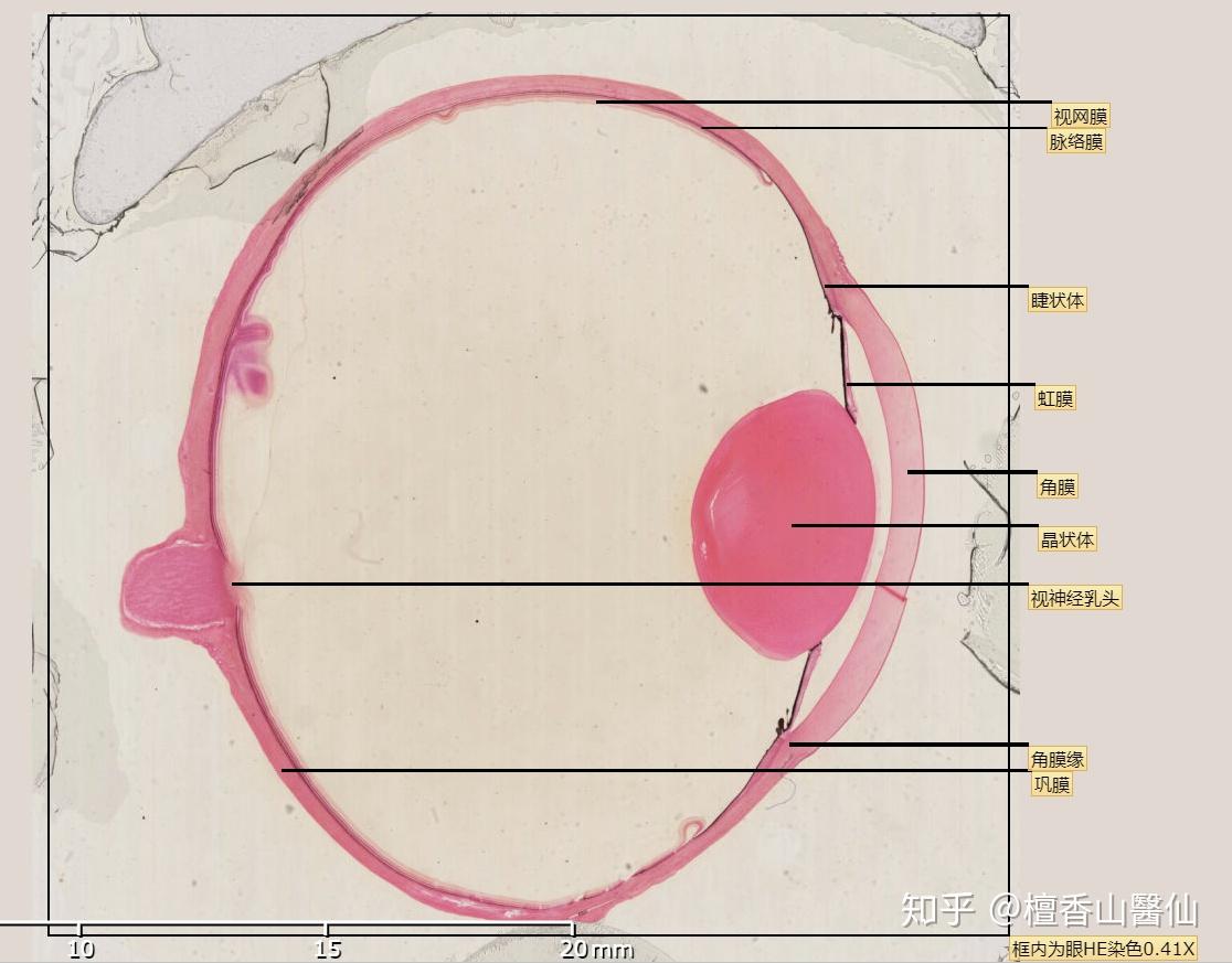 眼和耳光镜像he染色