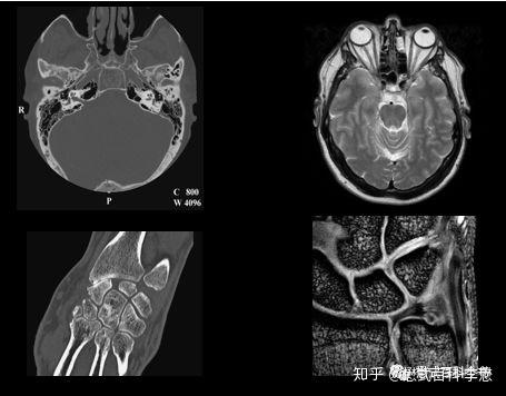 临床医生应该知道的磁共振知识 如何判断磁共振图像 知乎