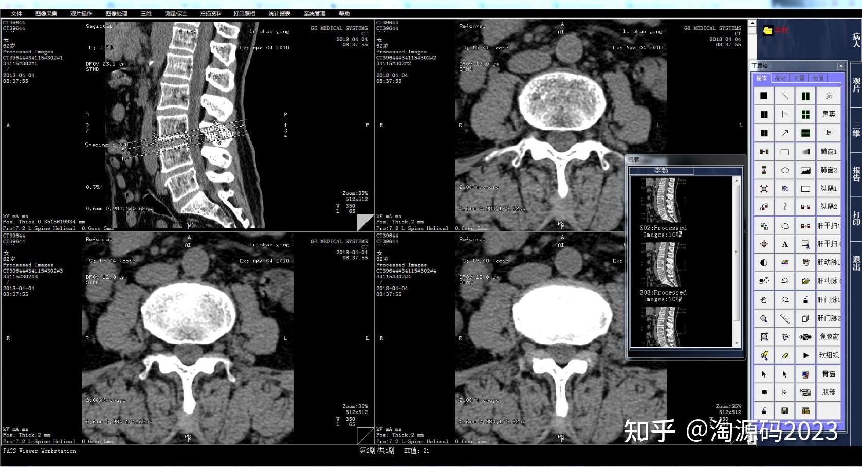 什么是医学影像pacs系统？pacs系统功能有哪些？作用有哪些？对接哪些设备？业务流程是什么？ 知乎