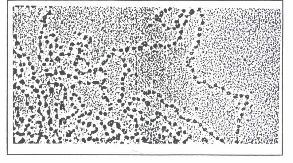 首先通过电镜看到染色质长什么样,但还不知其构成.