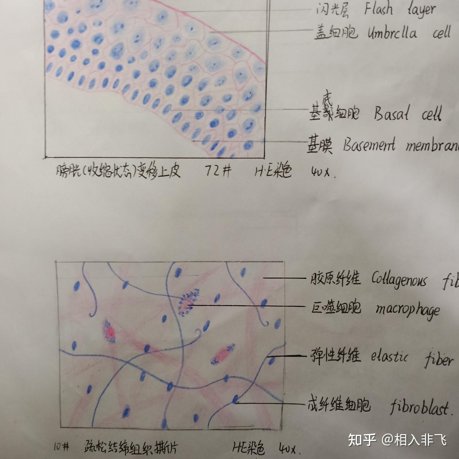 变移上皮图片手绘图片