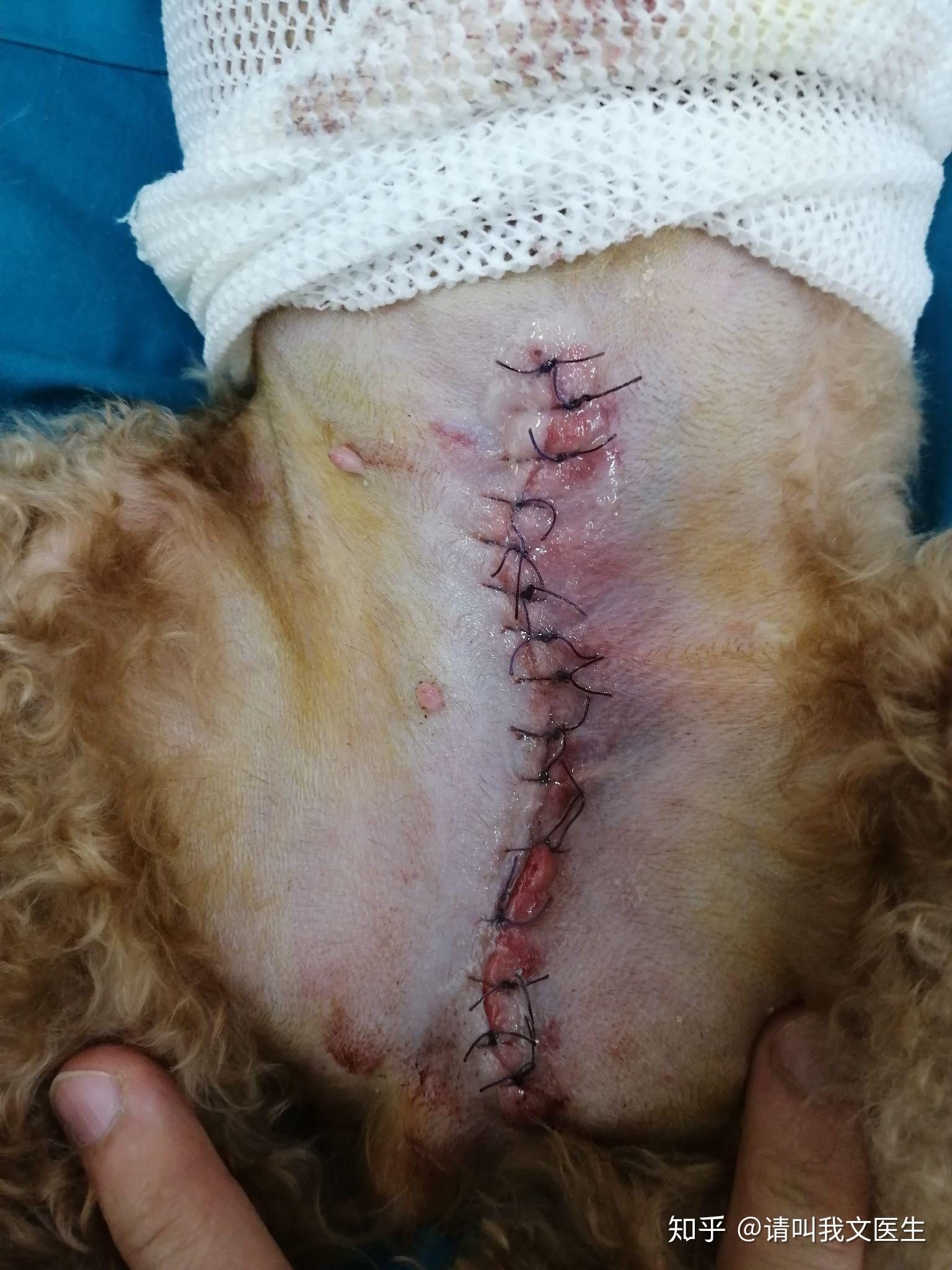 泰迪冰冰的乳腺肿瘤