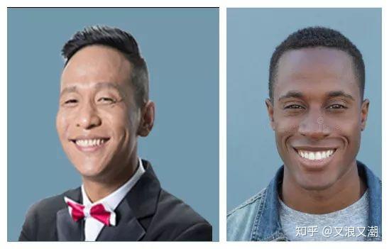 黄皮是什么原因 v2-dc64e3b01e77e4645bb217e3d8532cde_r.jpg