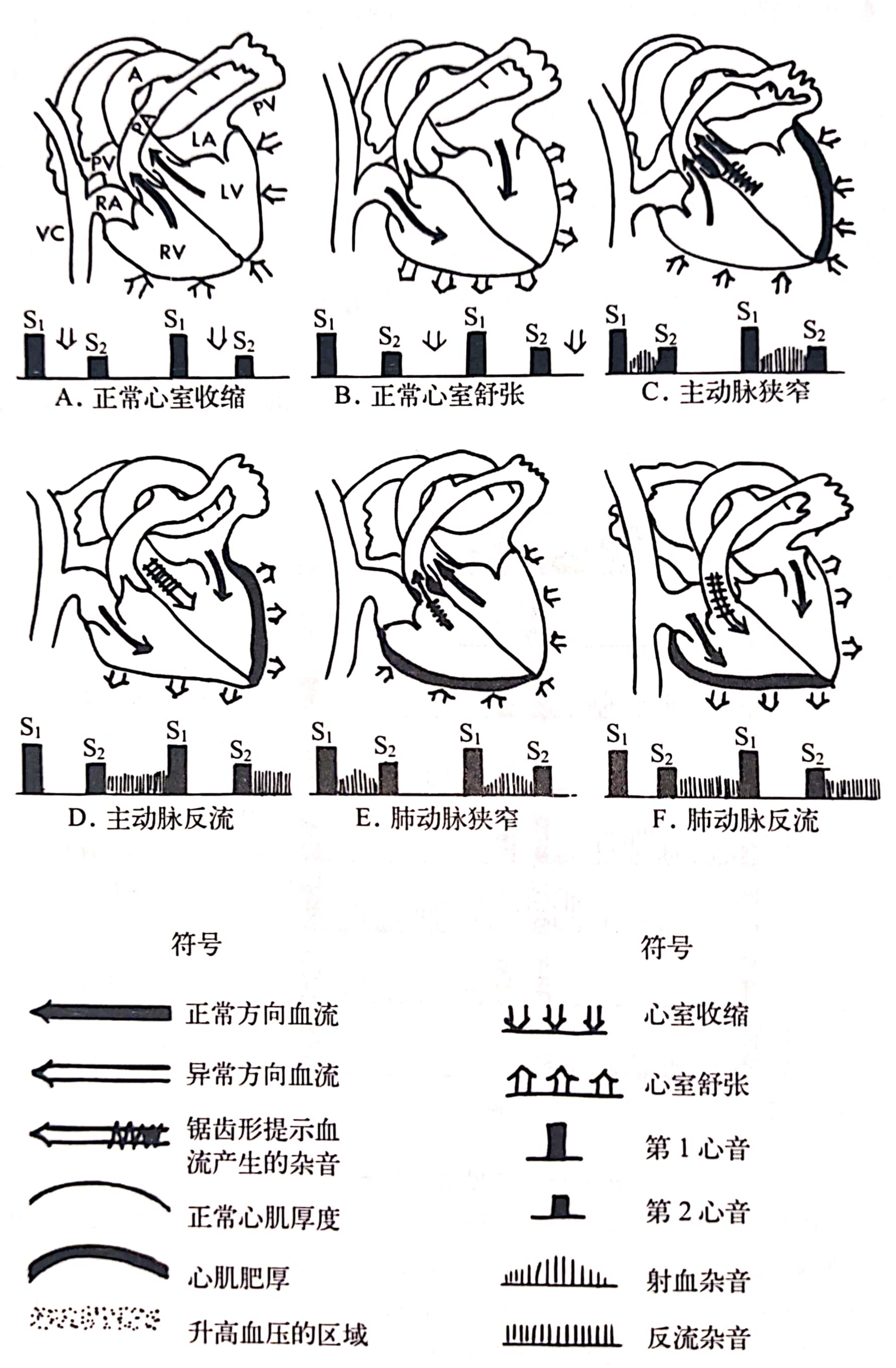 动脉瓣听诊区图片