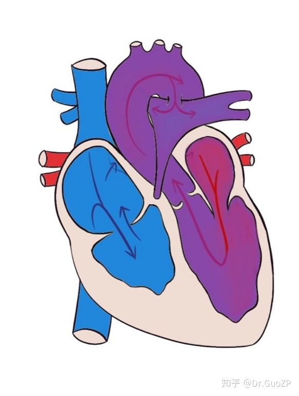 聊聊先天性心脏病肺动脉闭锁