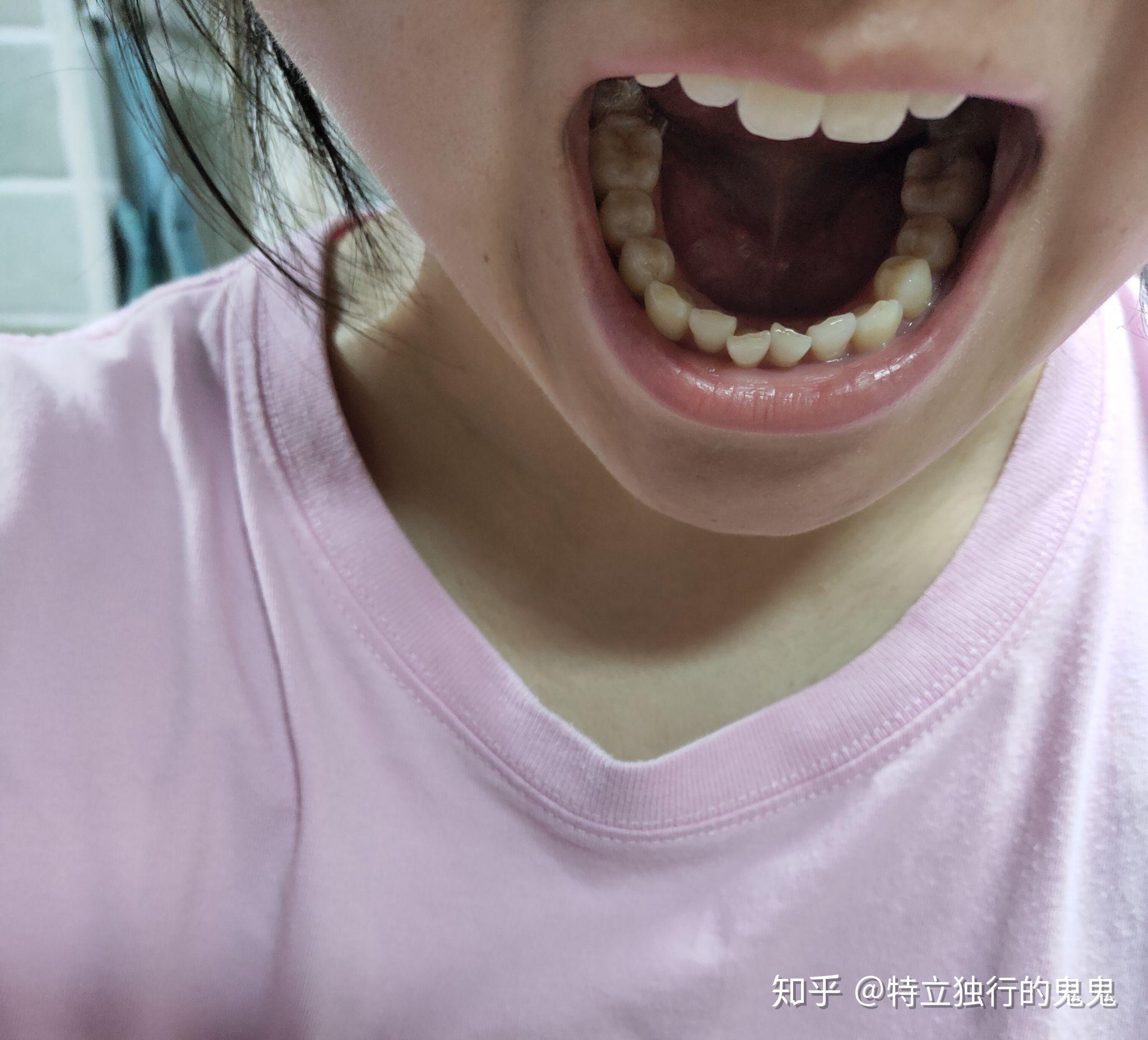 v2-dcbb20ca862dd99c6a9810c6eebf0b6a_r.jpg