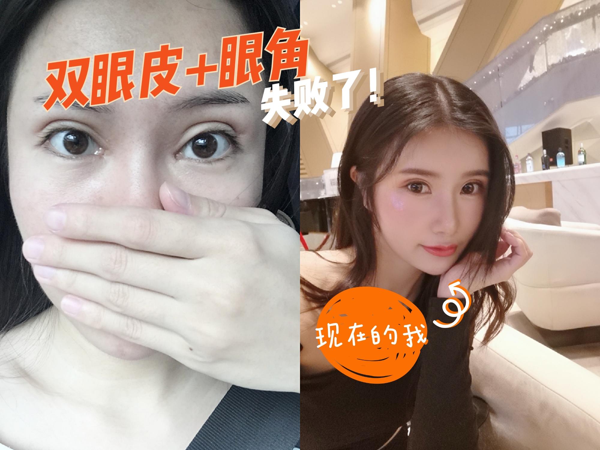 如何调整术后心态 送给整形失败正处于郁闷中的你 知乎