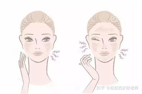 怎么了解自己是不是敏感肌 v2-dcd3dd28bbbafe206c84839695bad832_r.jpg