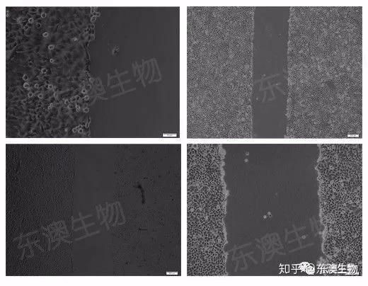 做实验 | "迁移攻略"之细胞划痕实验 - 知乎