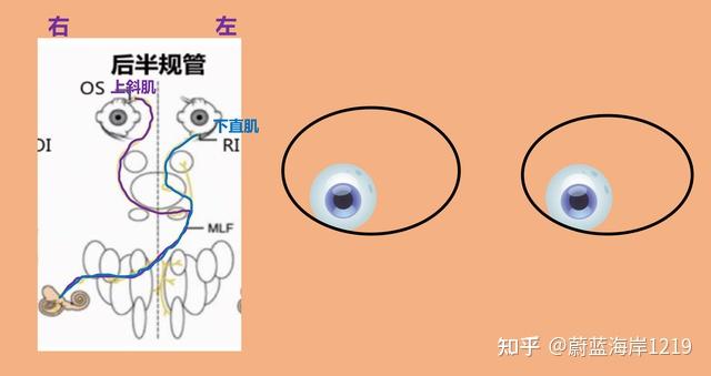 眼球震颤是如何产生的中枢与周围性眼震有何区别