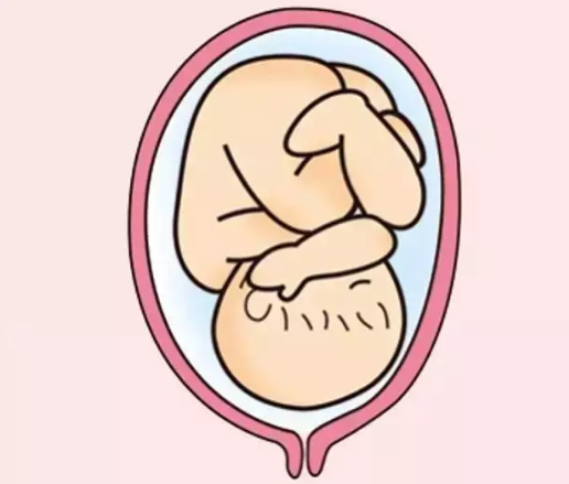 胎膜早破常见又危险一旦发生赶紧就医