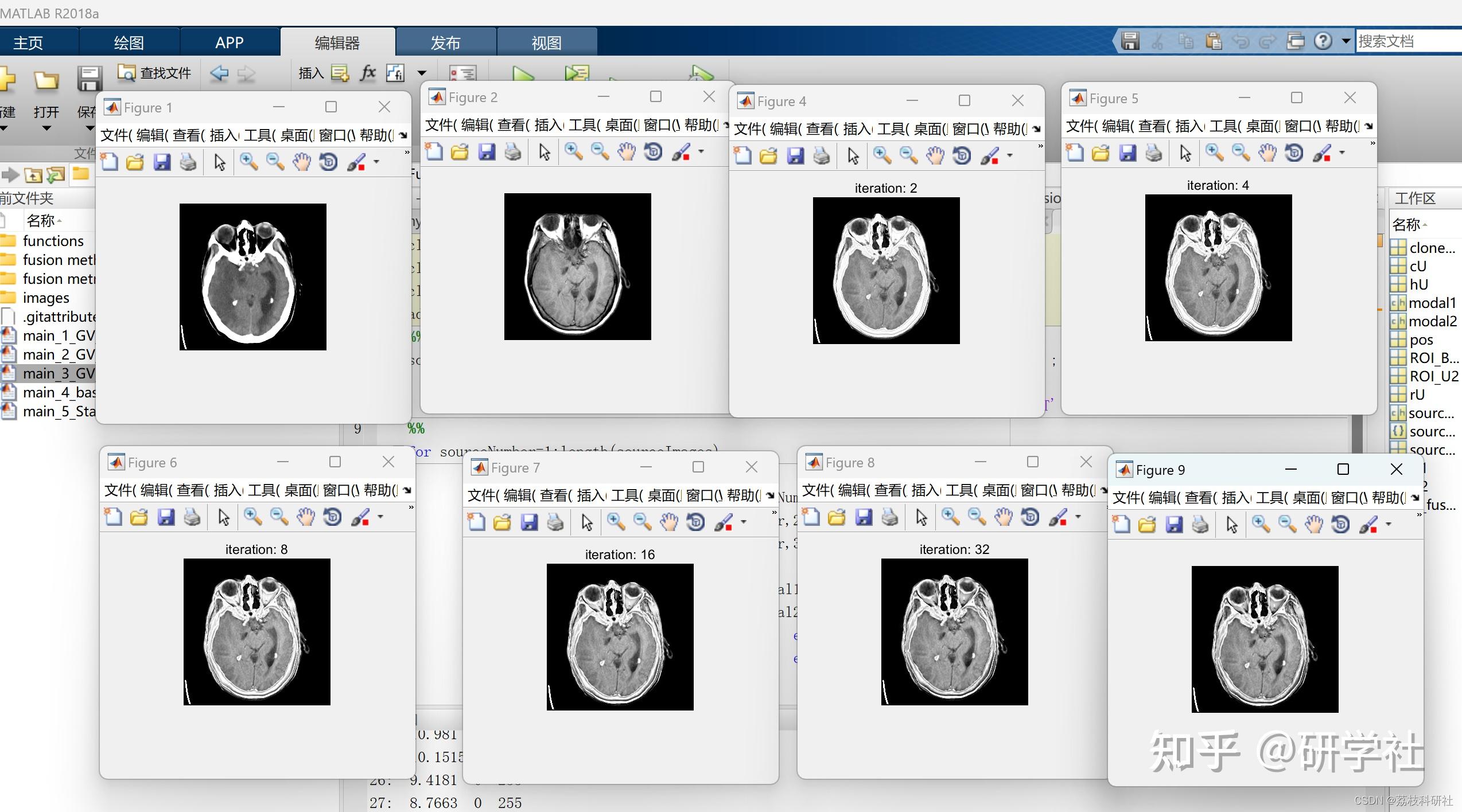  friedman matlab 