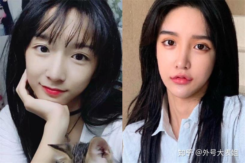 abbily通过整容改变男相失败后决定跨性别