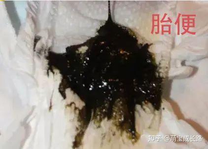 泡沫便 粘液便 绿便 宝宝各种性状及颜色的便便这里都有 知乎