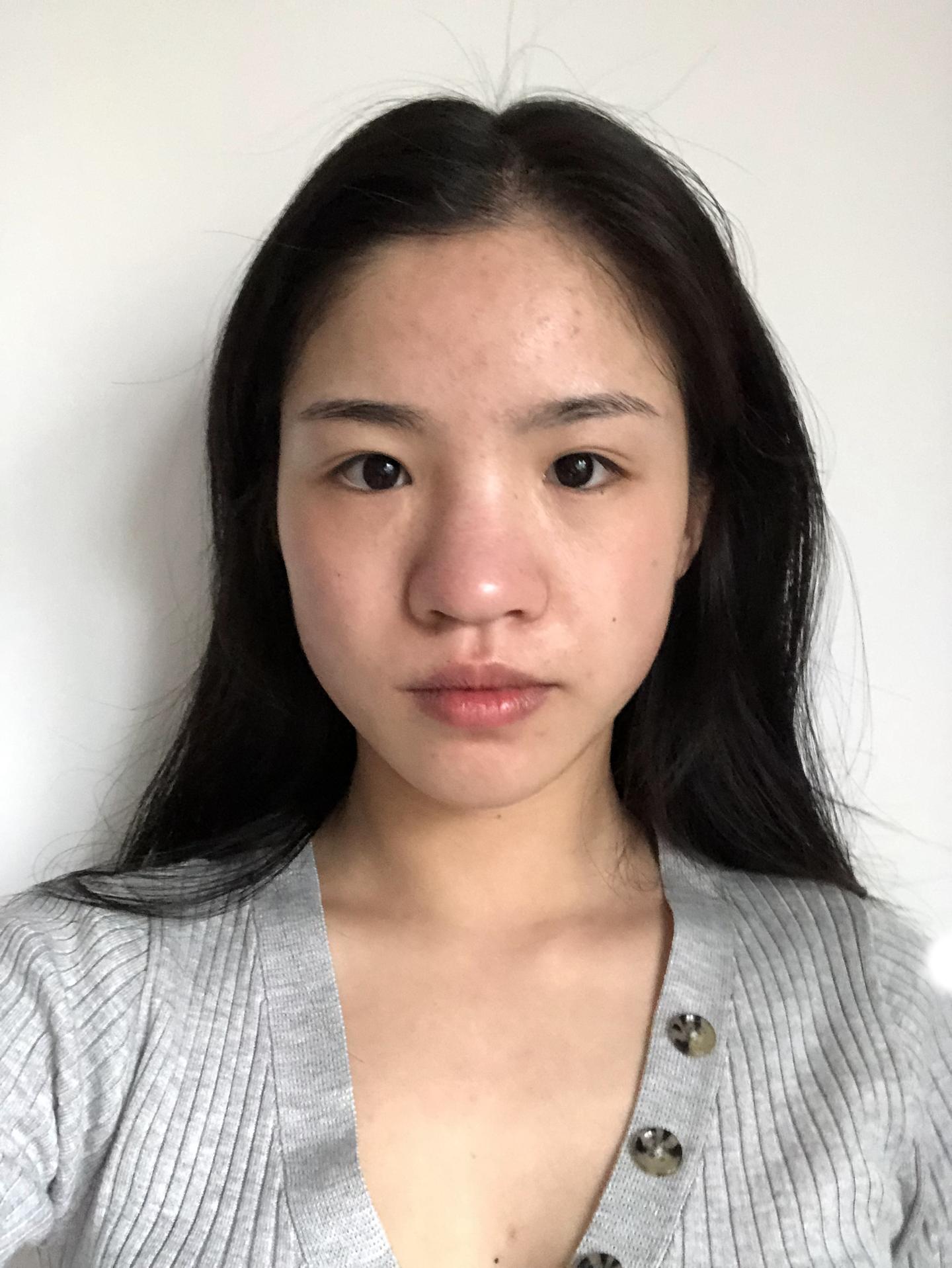 全脸只有鼻子不好看是一种怎样的体验