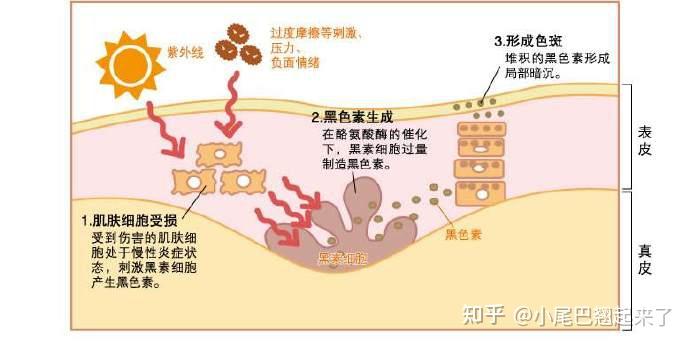 脸上痘痘反反复复怎么调 v2-ddb9231fb75c450e74c8e45d6924f17a_r.jpg