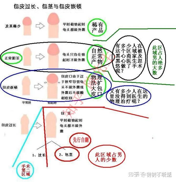 不是什么人都要去9915的,有的可以自翻成功!