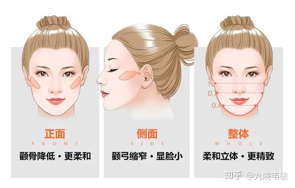 九院韦敏说,颧弓和颧骨,您分的清吗? - 知乎