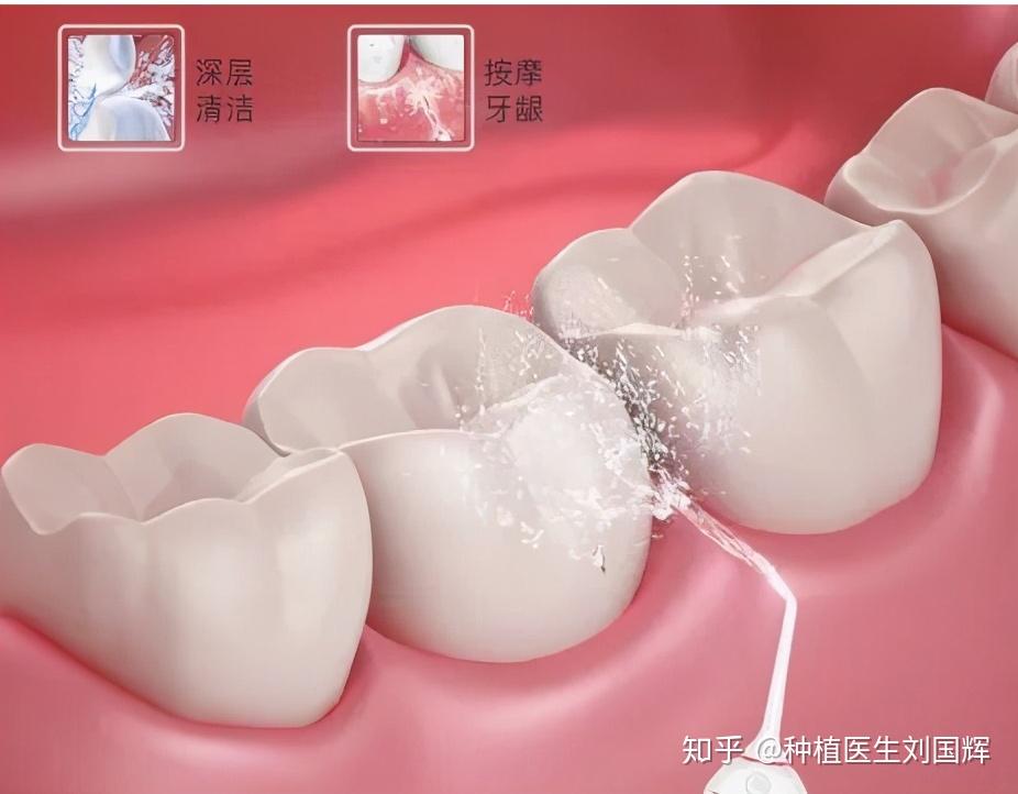 _tooth翻译成英文_toothbrush怎么翻译