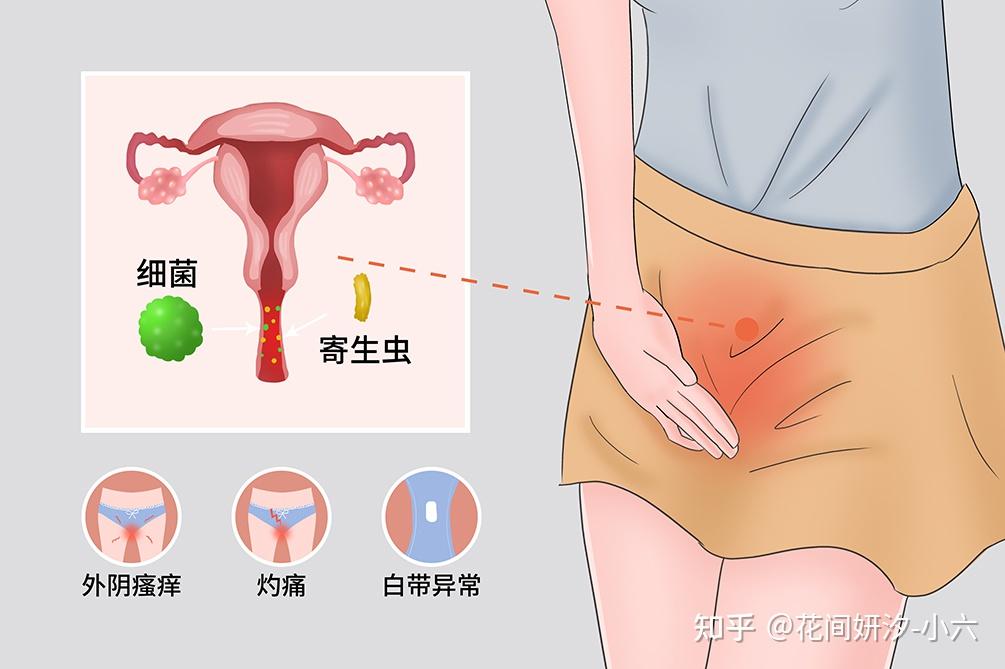 假丝酵母菌龟头炎症状图片