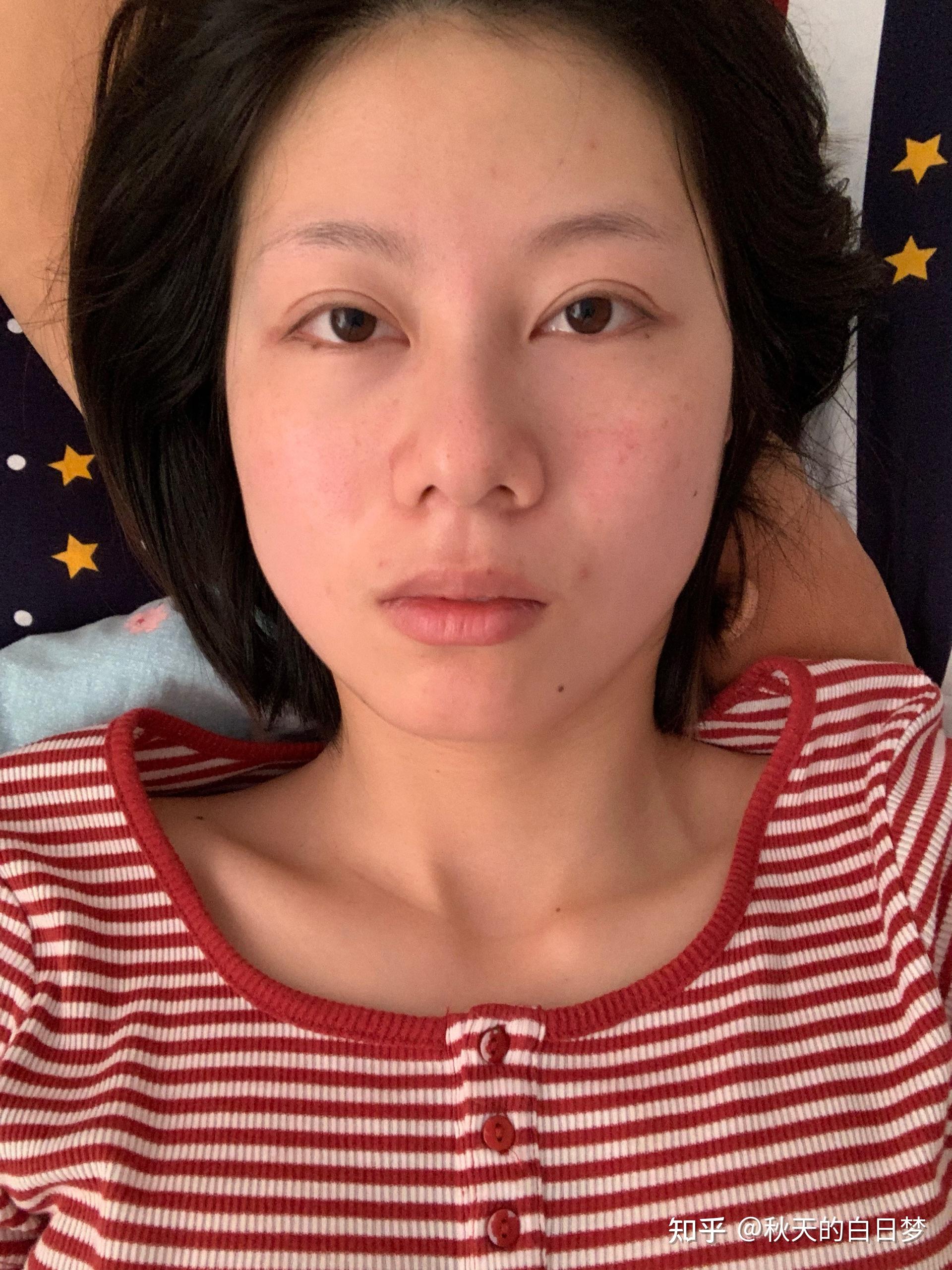 有没有鼻头大鼻翼宽但是鼻子很挺的人