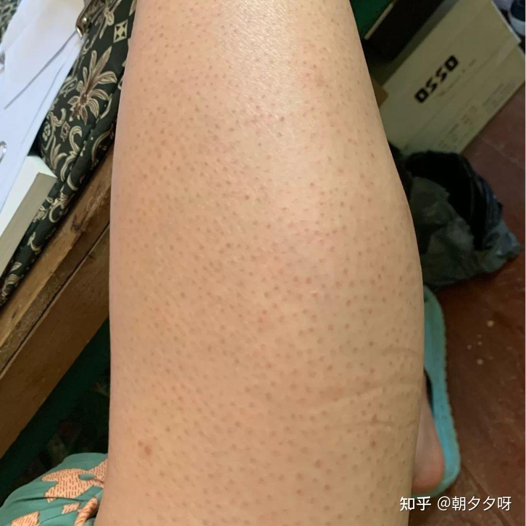 皮肤粗糙有暗沉,美白身体乳真的有效果吗?