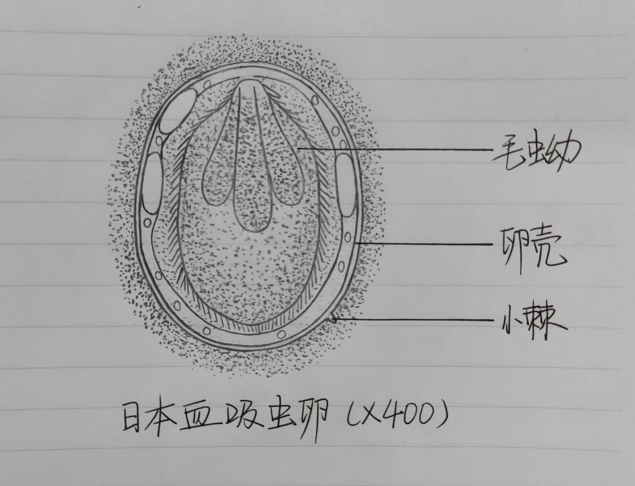 肺吸虫虫卵(卵壳下部较厚,上部较薄,虫卵形状不规则,上段较宽,下督舷