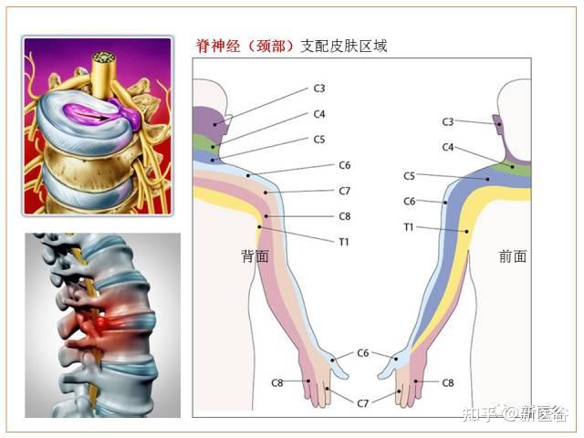 谷谷科普|颈椎病的解剖学基础 - 知乎
