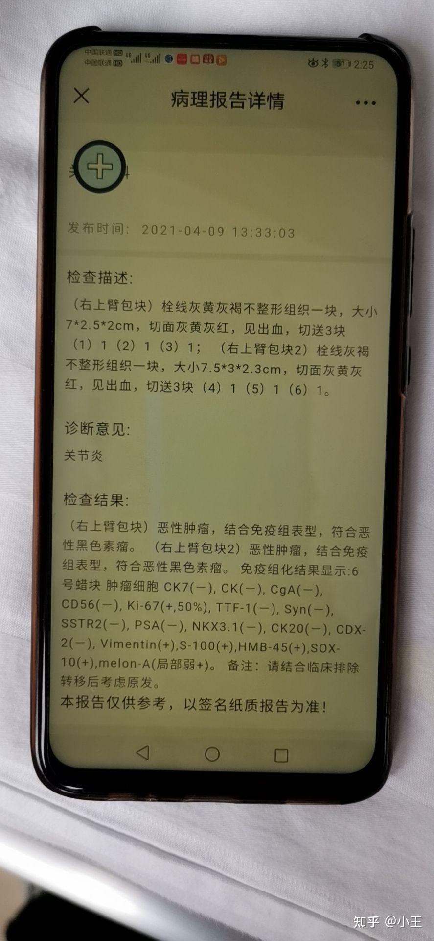 黑色素瘤的出路