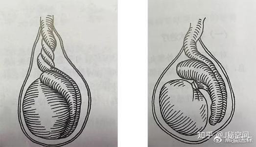 纵观各类奇葩医学报道,啪啪啪过程中用力不当或体位不对,提起重物时