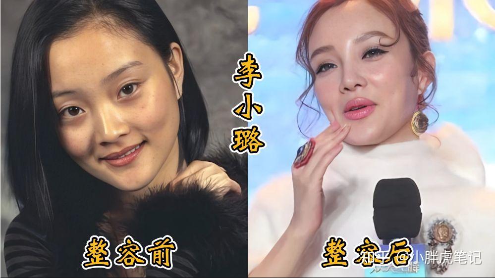 18位女明星整容前后对比，邵音音面目全非，杨颖堪称整容模板！ - 知乎