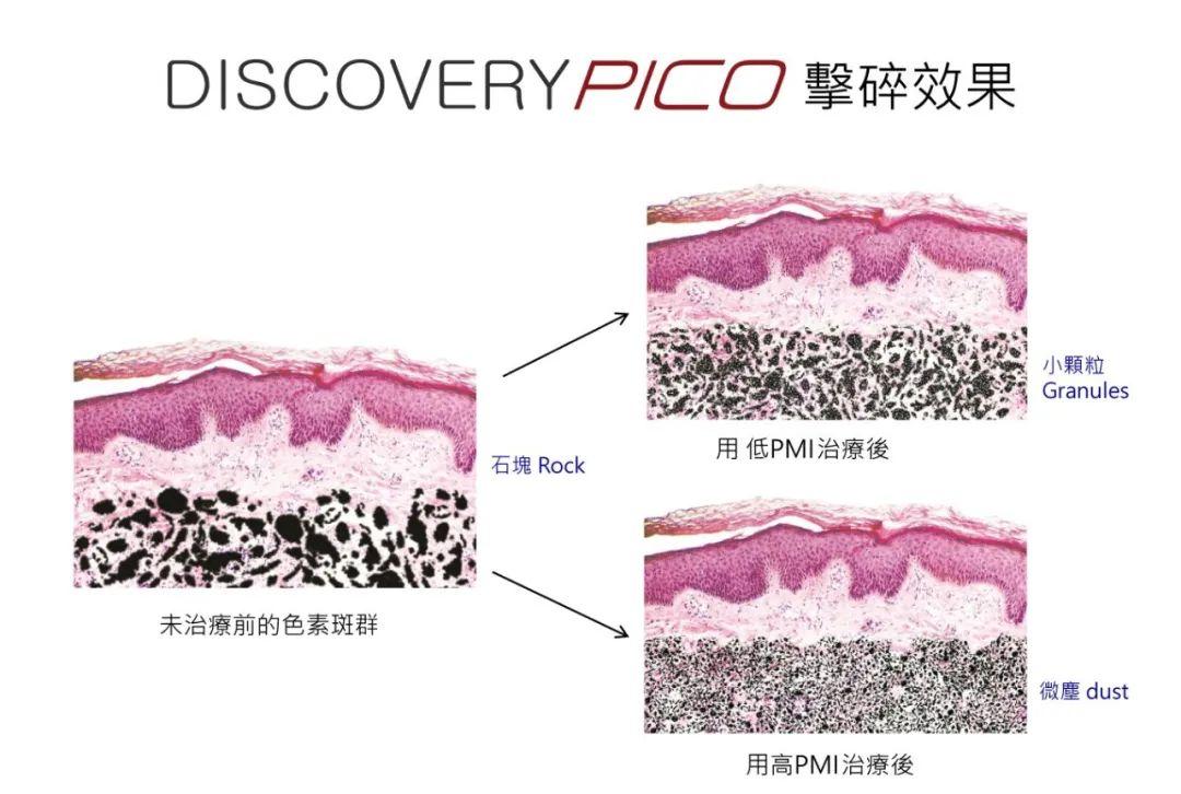 皮秒激光大百科,常见皮秒仪器如何选择? - 知乎