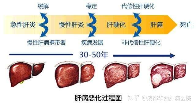 乙肝病人口扫_乙肝病人面部特征图片