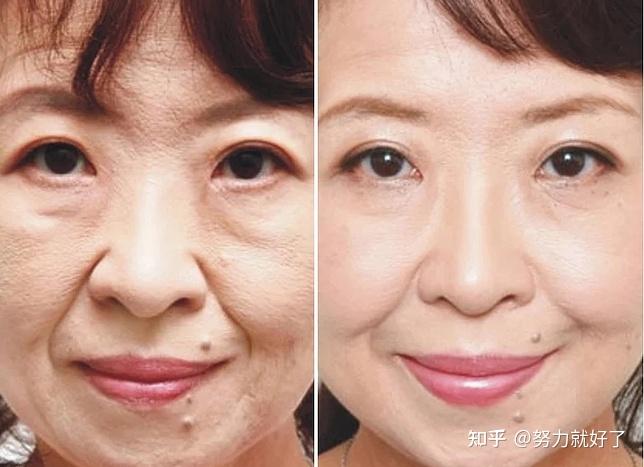 抗老抗皱纹的护肤品哪个好?孕妇护肤品排行榜10强? - 知乎